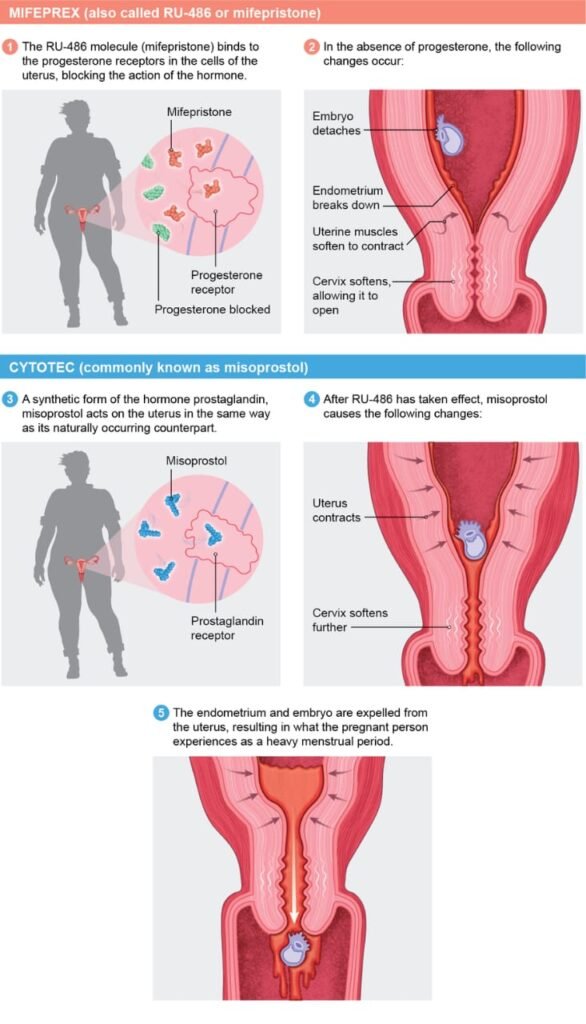 What is Cytotec Misoprostol in Dubai?