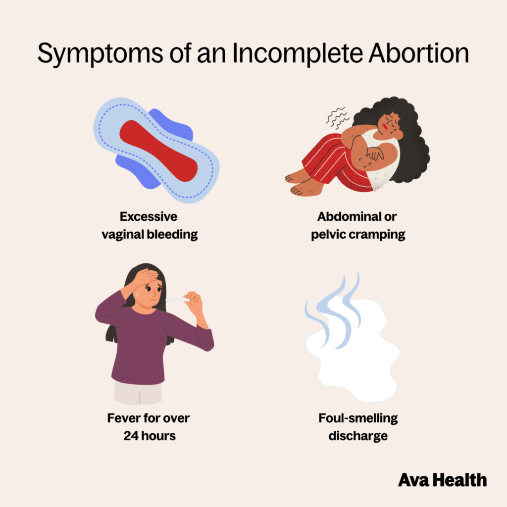 Symptoms of Incomplete Abortion